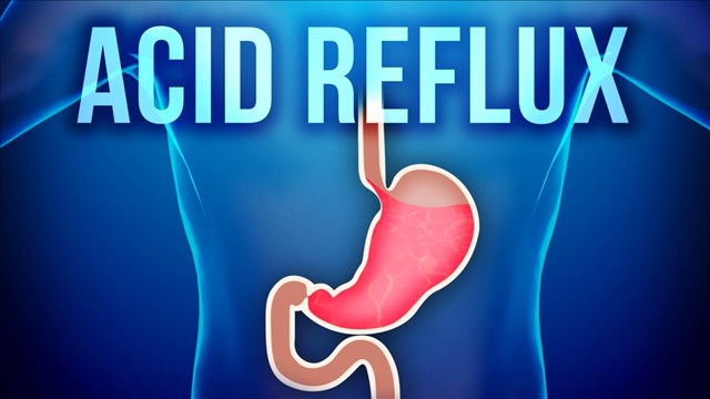 Simple Home Remedies for Acid Reflux | Oye! Times